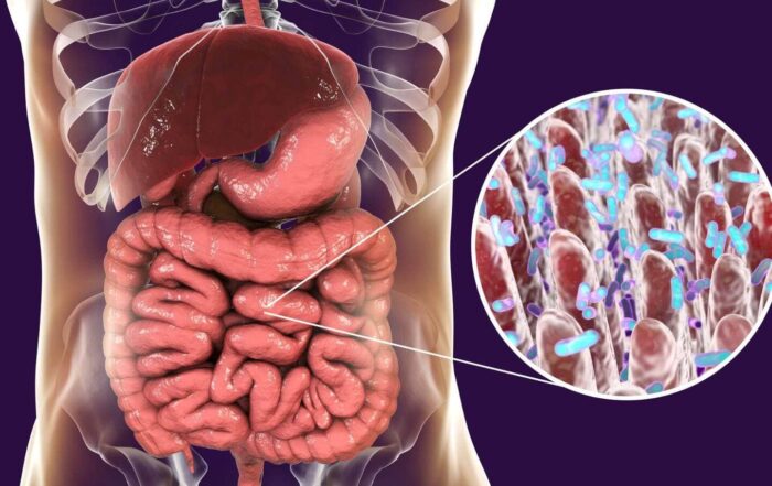 SIBO qué es, síntomas, tratamiento y dieta